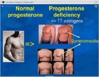 Progesterone-role in men deficiency=gynecomastia.jpg