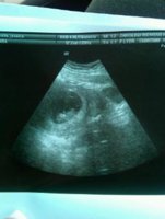 Ultrasound 1.jpg