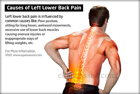 causes-of-left-lower-back-pain.jpg