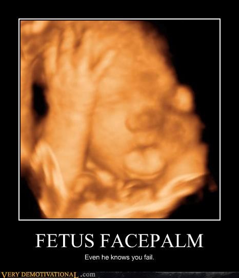 Fetus-Facepalm.jpg