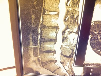 KEN'S SPINE.jpg