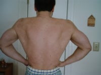 expansion dorsal.jpg