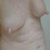 gyno.jpg