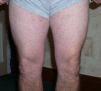 thighs1-15-03.jpg