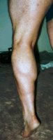 rleftcalf.jpg