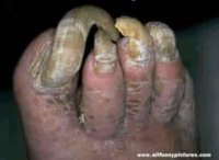 toenails.jpg