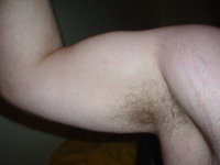 Arm.jpg