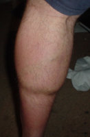 calf.jpg