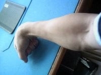 forarm.JPG
