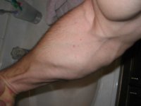 achrisforearm.JPG