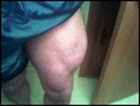 leg 08.jpg
