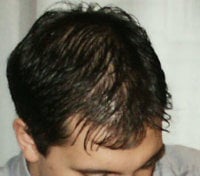 Before2.jpg