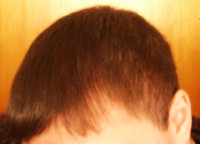 after2.jpg