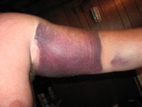 Michael's arm  001 (3).jpg