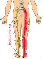 sciatic-nerve.jpg