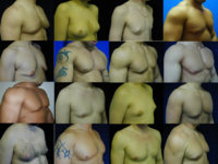 gyno.jpg