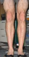 legs.jpg