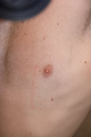 gyno?-1.jpg