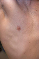 gyno?-2.jpg
