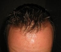 hairfront.jpg