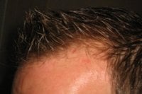 hairleft.jpg
