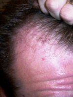 right side closeup 12-11.JPG