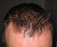 hairfront1.jpg