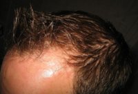 hairleft.jpg