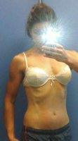 abs3.jpg