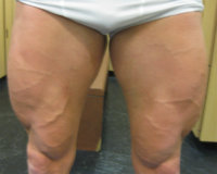 Legs.jpg