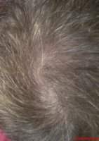 hair5.jpg