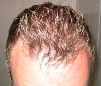 hairfront3.jpg