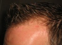 hairleft1.jpg