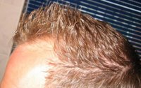 hairleft3.jpg