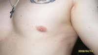 gyno2.jpg