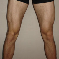 Legs Before.jpg