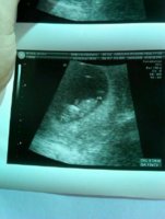 Ultrasound 2.jpg