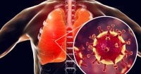 lung-infection.jpg