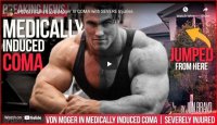 Calum-Von-Moger-in-Coma.jpg