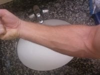 Forearm.jpg