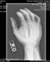 hand.jpg