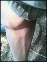 rightcalve.jpeg
