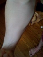 forearm.jpg
