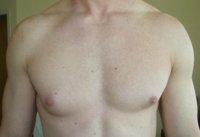 gyno.jpg