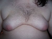 800px-Gynecomastia_001.jpg