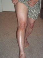 right Leg.jpg