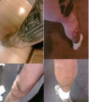 LEGSBEFOREAFTER.jpg