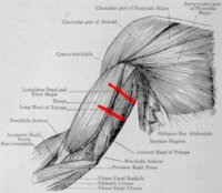 hurt tricep copy.jpg
