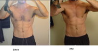 Before_After2.JPG