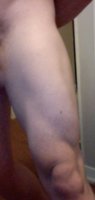 hdrolbeforeleg.jpg